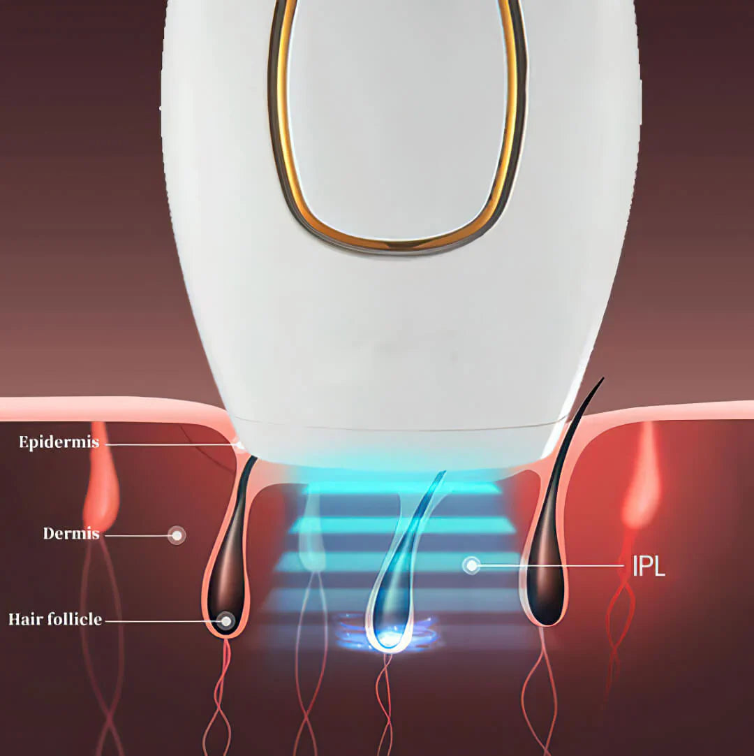 Painless Laser Epilator